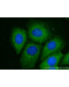 AP3D1 Polyclonal antibody 16454-1-AP proteintech