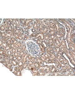 ADH4 Polyclonal antibody 16474-1-AP proteintech