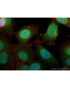 COPS7A Polyclonal antibody 16628-1-AP proteintech