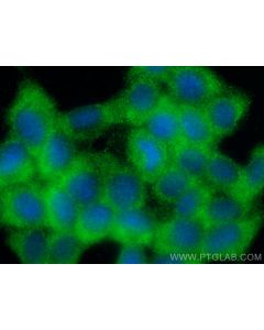 TKTL2 Polyclonal antibody 17135-1-AP proteintech