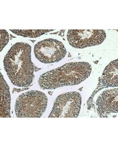 DNAJB3 Polyclonal antibody 17177-1-AP proteintech