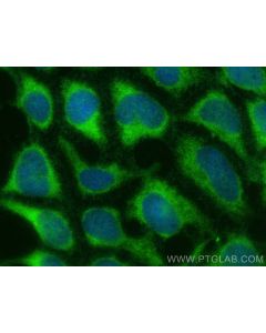 NARG1L Polyclonal antibody 17427-1-AP proteintech