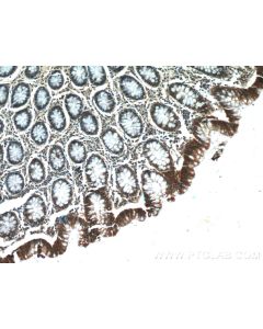 Oligophrenin 1 Polyclonal antibody 17445-1-AP proteintech