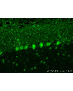 ZNF8 Polyclonal antibody 17448-1-AP proteintech