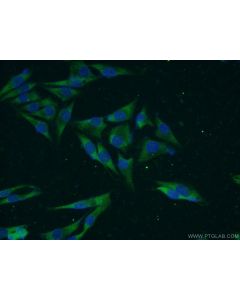 VWA2 Polyclonal antibody 18714-1-AP proteintech