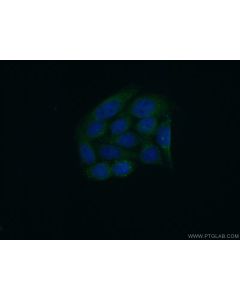 PSKH2 Polyclonal antibody 18813-1-AP proteintech