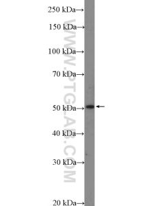 TFAP2D Polyclonal antibody 18835-1-AP proteintech