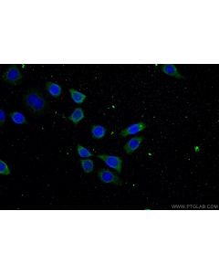 ATP9A Polyclonal antibody 19504-1-AP proteintech