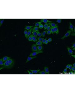 DLEC1 Polyclonal antibody 20027-1-AP proteintech