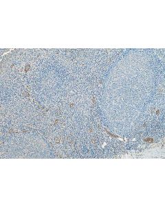 Stabilin-1 Polyclonal antibody 20663-1-AP proteintech