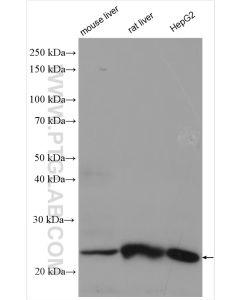 TMEM41A Polyclonal antibody 20768-1-AP proteintech