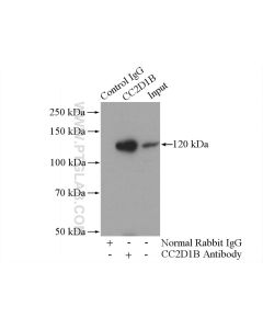 CC2D1B Polyclonal antibody 20774-1-AP proteintech