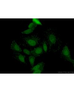 DAX-1 Polyclonal antibody 20849-1-AP proteintech