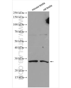 C9orf7 / CACFD1 Polyclonal antibody 21330-1-AP proteintech