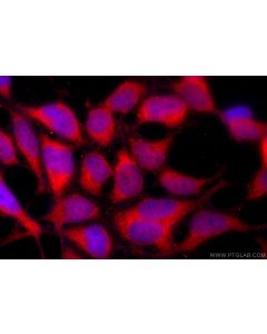 C21orf59 Polyclonal antibody 21461-1-AP proteintech
