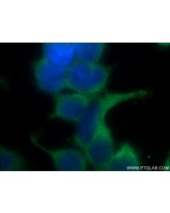 Kindlin 1 Polyclonal antibody 22215-1-AP proteintech