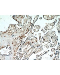 p57Kip2 Polyclonal antibody 23317-1-AP proteintech