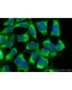 C16orf84 Polyclonal antibody 23337-1-AP proteintech