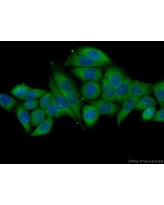 NARG1 Polyclonal antibody 23845-1-AP proteintech