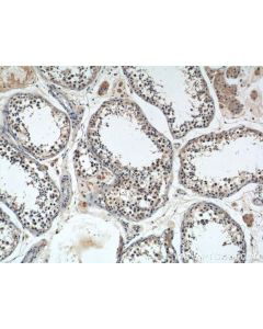 PRPF6 Polyclonal antibody 23929-1-AP proteintech