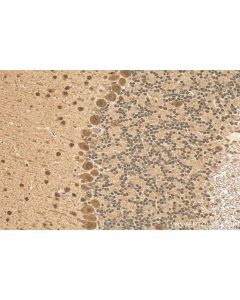 ACIN1 Polyclonal antibody 23937-1-AP proteintech