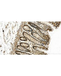 SOD2 Polyclonal antibody 24127-1-AP proteintech