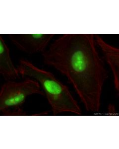 EXOSC9 Polyclonal antibody 24470-1-AP proteintech