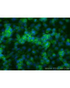 PRY Polyclonal antibody 24688-1-AP proteintech