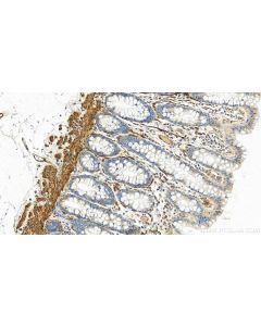 Calponin 1 Polyclonal antibody 24855-1-AP proteintech
