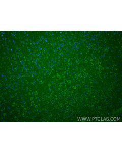 FAM82B Polyclonal antibody 24919-1-AP proteintech