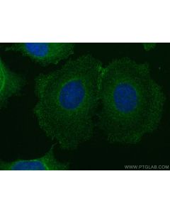 LRCH1 Polyclonal antibody 25017-1-AP proteintech
