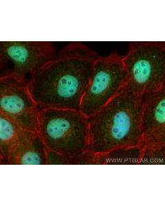PPM1E Polyclonal antibody 25089-1-AP proteintech