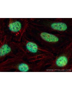 CCDC12 Polyclonal antibody 25138-1-AP proteintech