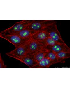 RSL24D1 Polyclonal antibody 25190-1-AP proteintech