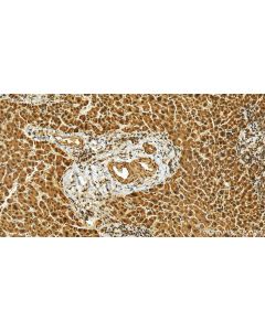 FAM160B1 Polyclonal antibody 25388-1-AP proteintech