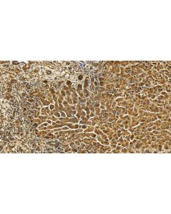 TTDN1 Polyclonal antibody 25410-1-AP proteintech