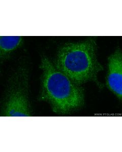 DENND1A Polyclonal antibody 25658-1-AP proteintech