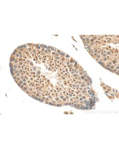 ZNF639 Polyclonal antibody 25817-1-AP proteintech