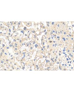 Alpha-1-antitrypsin Polyclonal antibody 25876-1-AP proteintech