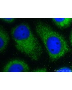SPACA9 Polyclonal antibody 26034-1-AP proteintech