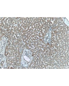 Mitoferrin 1 Polyclonal antibody 26469-1-AP proteintech