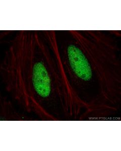 DNA ligase III/LIG3 Polyclonal antibody 26583-1-AP proteintech