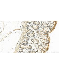 IL-24 Polyclonal antibody 26772-1-AP proteintech