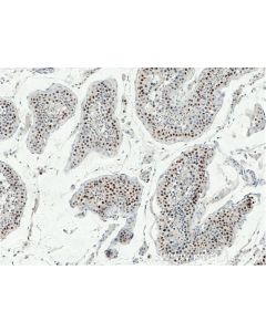 TP53RK Polyclonal antibody 26818-1-AP proteintech