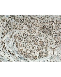 Fibrillin 1 Polyclonal antibody 26935-1-AP proteintech