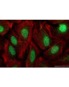 HOXA5 Polyclonal antibody 27622-1-AP proteintech