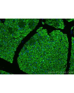 Perilipin 1 Polyclonal antibody 27716-1-AP proteintech