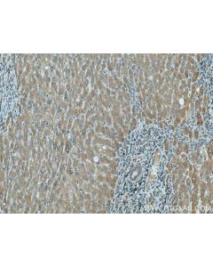 PTPLAD1 Polyclonal antibody 28572-1-AP proteintech