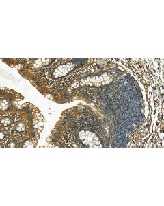 Fibrillin 1 Polyclonal antibody 29425-1-AP proteintech