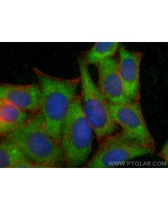 HTRA1 Polyclonal antibody 29618-1-AP proteintech